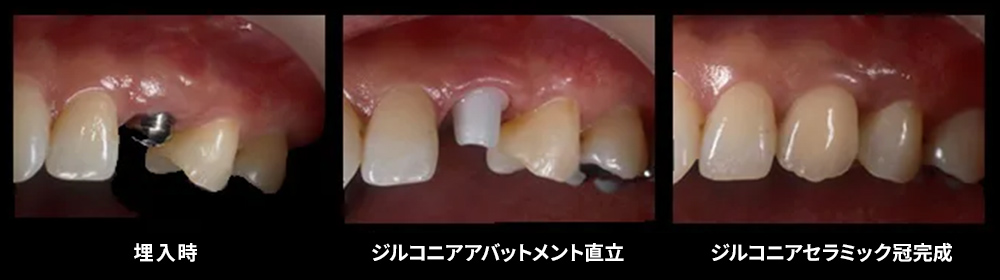 症例写真