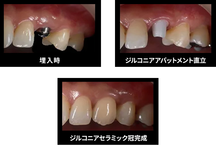 症例写真